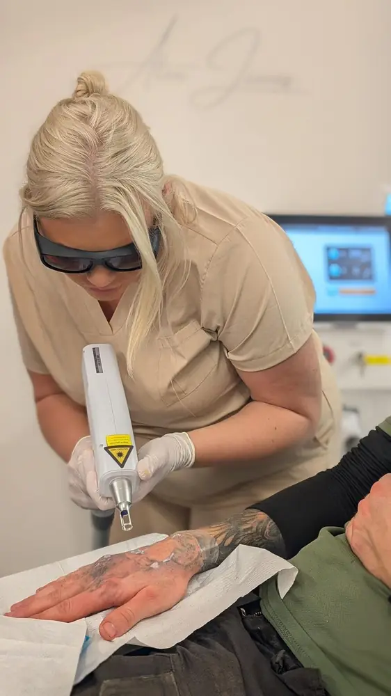 Kelsea performing laser tattoo removal on a client’s hand