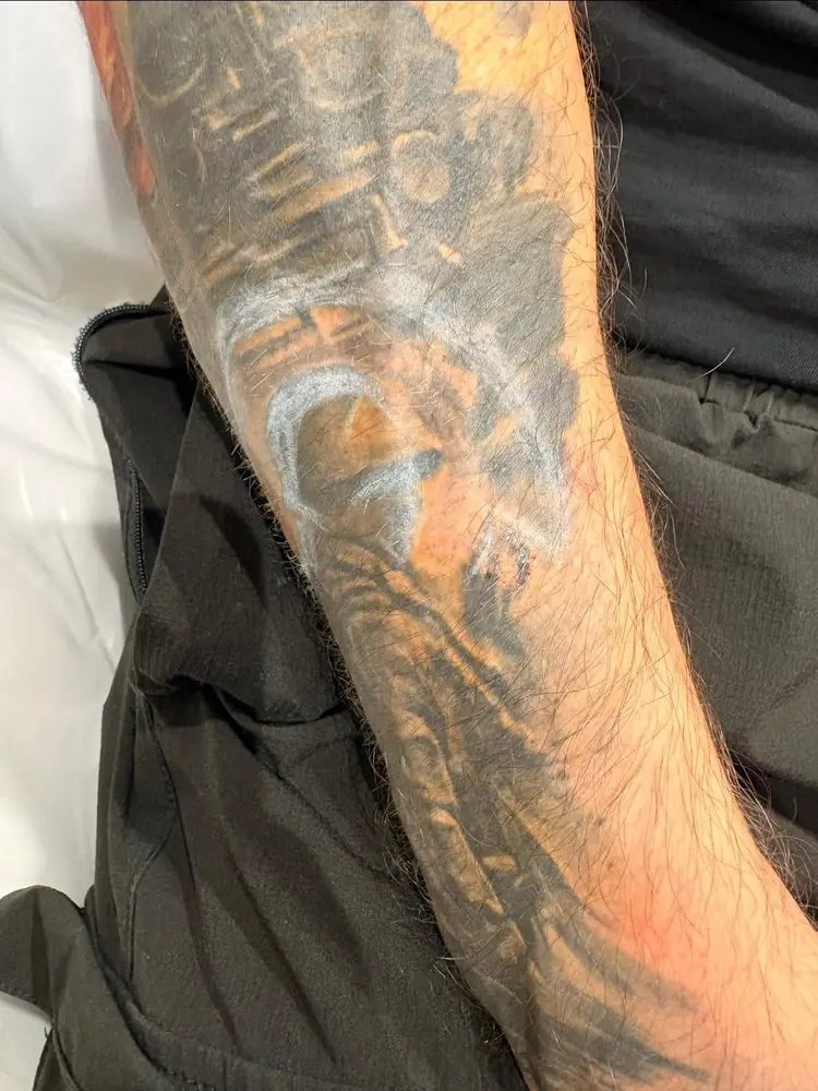 Forearm tattoo fading as it heals between sessions
